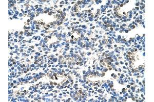 EIF2S1 antibody was used for immunohistochemistry at a concentration of 4-8 ug/ml to stain Alveolar cells (arrows) in Human Lung.