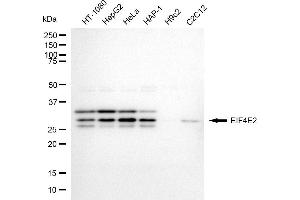 Western blotting analysis using EIF4E2 antibody (ABIN7798533). (EIF4E2 抗体)