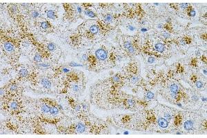 Immunohistochemistry of paraffin-embedded Human liver damage using NPC2 Polyclonal Antibody at dilution of 1:100 (40x lens). (NPC2 抗体)