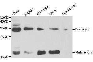 Western blot analysis of extracts of various cell lines, using NGF antibody. (Nerve Growth Factor 抗体  (AA 19-241))