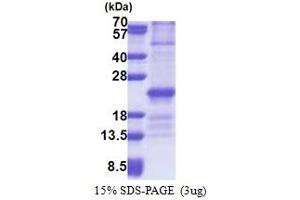 SDS-PAGE (SDS) image for Zinc Finger, HIT-Type Containing 3 (ZNHIT3) (AA 1-155) protein (His tag) (ABIN5853239)