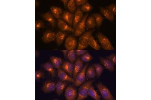 Immunofluorescence analysis of HeLa cells using B3GNT4 antibody (ABIN7265875) at dilution of 1:100. (B3GNT4 抗体  (AA 165-305))