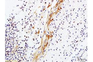 Formalin-fixed and paraffin-embedded rat skin tissue labeled with Anti-Collagen V Polyclonal Antibody, Unconjugated  1:200 followed by conjugation to the secondary antibody and DAB staining (Collagen Type V 抗体  (AA 1450-1500))