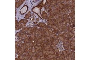 Immunohistochemical staining of human pancreas with ANKRD39 polyclonal antibody  shows strong cytoplasmic positivity in exocrine glandular cells at 1:10-1:20 dilution. (ANKRD39 抗体)