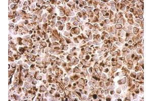 IHC-P Image Desmin antibody detects DES protein at cytosol on H1299 xenograft by immunohistochemical analysis. (Desmin 抗体)