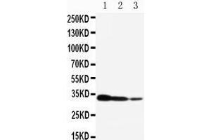 Western Blotting (WB) image for anti-CREB Regulated Transcription Coactivator 2 (CRTC2) (AA 595-611), (C-Term) antibody (ABIN3042964) (CRTC2 抗体  (C-Term))