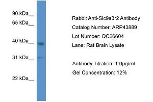 Western Blotting (WB) image for anti-Solute Carrier Family 9 (Sodium/hydrogen Exchanger), Member 3 Regulator 2 (SLC9A3R2) (N-Term) antibody (ABIN2781612) (SLC9A3R2 抗体  (N-Term))