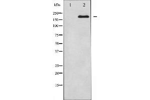 Western blot analysis of BRCA1 expression in whole cell lysates,The lane on the left is treated with the antigen-specific peptide. (BRCA1 抗体  (Internal Region))