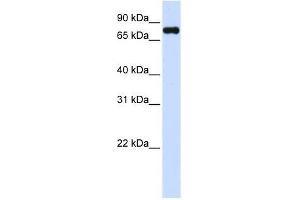Western Blot showing ZFYVE1 antibody used at a concentration of 1-2 ug/ml to detect its target protein. (ZFYVE1 抗体  (C-Term))