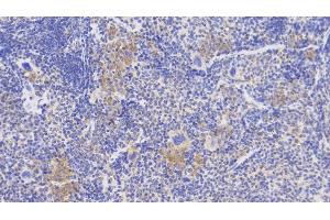 Detection of DBI in Mouse Spleen Tissue using Polyclonal Antibody to Diazepam Binding Inhibitor (DBI)