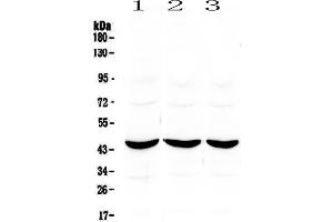 Western blot analysis of ADA using anti-ADA antibody . (ADA 抗体  (AA 2-238))