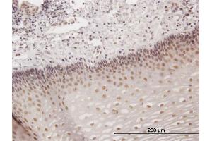 Immunoperoxidase of purified MaxPab antibody to KIAA1443 on formalin-fixed paraffin-embedded human esophagus. (HOMEZ 抗体  (AA 1-526))
