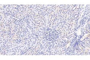 Detection of PDGFC in Human Kidney Tissue using Polyclonal Antibody to Platelet Derived Growth Factor C (PDGFC) (PDGFC 抗体  (AA 235-345))