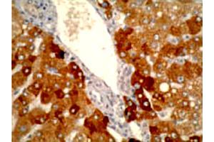 Immunohistochemistry staining using CYP2A6 monoclonal antibody, clone F16 P2 D8  on normal human liver tissue at 1 ug/mL . (CYP2A6 抗体  (C-Term))