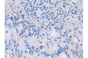 Detection of LRP1 in Human Lung Tissue using Polyclonal Antibody to Low Density Lipoprotein Receptor Related Protein 1 (LRP1) (LRP1 抗体  (AA 4441-4544))