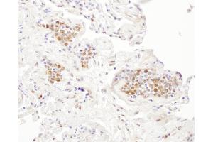 anti-Cyclin-Dependent Kinase 5, Regulatory Subunit 1 (p35) (CDK5R1) (AA 110-160) antibody