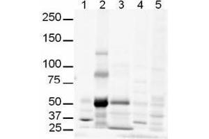 Image no. 1 for anti-GLI Family Zinc Finger 3 (GLI3) (AA 41-57) antibody (ABIN401281) (GLI3 抗体  (AA 41-57))