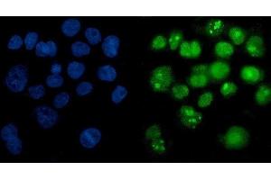 IF analysis of PARP using anti-PARP antibody (ABIN7602277). (PARP1 抗体  (AA 670-858))