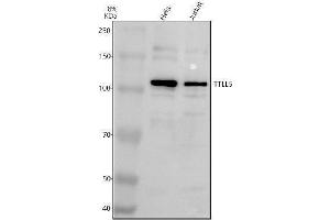 anti-Tubulin tyrosine Ligase-Like Family, Member 5 (TTLL5) (AA 111-1015) antibody