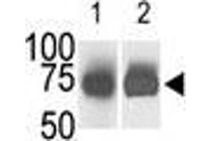 The anti-SphK2 Pab is used in Western blot (Lane 1) to detect c-myc-tagged SphK2 in transfected 293 cell lysate (a c-myc antibody is used as control in Lane 2). (SPHK2 抗体  (N-Term))