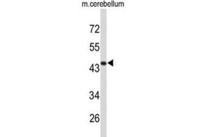 Western Blotting (WB) image for anti-Fibromodulin (FMOD) antibody (ABIN3004097) (Fibromodulin 抗体)