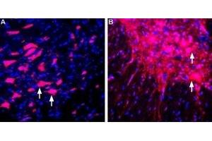 Expression of LINGO-1 in rat brain and spinal cord - Immunohistochemical staining of perfusion-fixed frozen rat brain sections using Anti-LINGO-1 (extracellular) Antibody (ABIN7043298, ABIN7044790 and ABIN7044791), (1:400), followed by donkey-anti-rabbit-Cy3. (LINGO1 抗体  (Extracellular, N-Term))