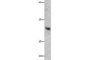 Western blot analysis of Mouse liver tissue, using GFER Polyclonal Antibody at dilution of 1:750 (GFER 抗体)