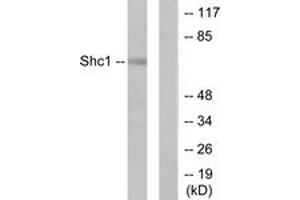 Western blot analysis of extracts from HeLa cells, treated with Calyculin A 50nM 15', using Shc (Ab-427) Antibody. (SHC1 抗体  (AA 393-442))