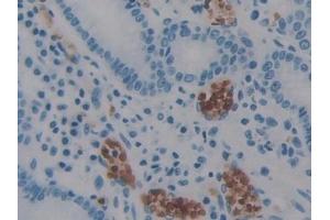 Detection of AIF in Human Stomach Tissue using Polyclonal Antibody to Apoptosis Inducing Factor (AIF)