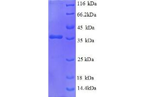 SDS-PAGE (SDS) image for Heat Shock Factor Binding Protein 1 (HSBP1) (AA 1-75), (partial) protein (GST tag) (ABIN5712057)