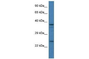 Western Blot showing GAP43 antibody used at a concentration of 1 ug/ml against 293T Cell Lysate (GAP43 抗体  (C-Term))