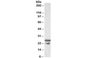 Western blot testing of mouse spleen lysates with ASC antibody at 0. (PYCARD 抗体)