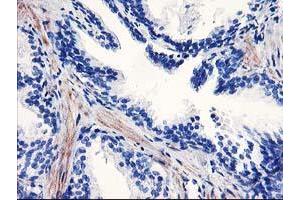 Immunohistochemical staining of paraffin-embedded Human prostate tissue using anti-PPARA mouse monoclonal antibody. (PPARA 抗体  (AA 145-420))