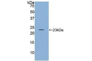 Western blot analysis of recombinant Human RGS4. (RGS4 抗体  (AA 38-205))