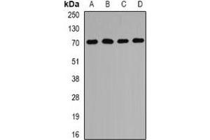 Western blot analysis of PEX5 expression in MCF7 (A), Hela (B), mouse liver (C), mouse kidney (D) whole cell lysates. (PEX5 抗体)