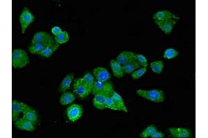 Immunofluorescent analysis of HepG2 cells using ABIN7158800 at dilution of 1:100 and Alexa Fluor 488-congugated AffiniPure Goat Anti-Rabbit IgG(H+L) (SCARB2 抗体  (AA 47-128))