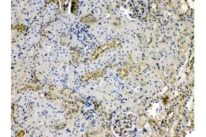 IHC analysis of PNP using anti-PNP antibody . (PNP 抗体  (Middle Region))