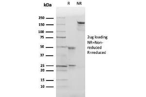 SDS-PAGE Analysis of Purified p27 Mouse Monoclonal Antibody (SX53G8). (CDKN1B 抗体)