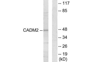 Western Blotting (WB) image for anti-Cell Adhesion Molecule 2 (CADM2) (Internal Region) antibody (ABIN1850234) (CADM2 抗体  (Internal Region))