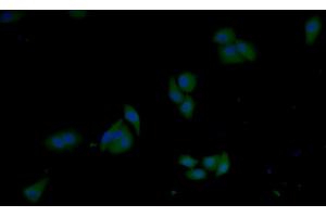 Detection of GSTp in Human MCF7 cell using Polyclonal Antibody to Glutathione S Transferase Pi (GSTp) (GSTP1 抗体  (AA 1-210))
