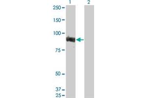 Western Blot analysis of TOP3B expression in transfected 293T cell line by TOP3B monoclonal antibody (M06), clone 2G2. (TOP3B 抗体  (AA 1-862))