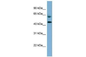 RMND1 antibody used at 1 ug/ml to detect target protein. (RMND1 抗体)