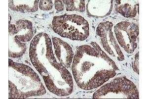 Image no. 1 for anti-Methionyl Aminopeptidase 2 (METAP2) (AA 2-212) antibody (ABIN1491153) (METAP2 抗体  (AA 2-212))