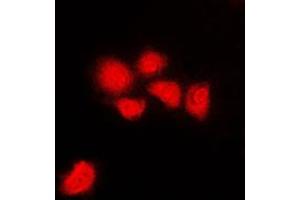 Immunofluorescent analysis of CDK1/2/3 (pT14) staining in HeLa cells. (CDK1/2/3 (N-Term), (pSer14) 抗体)