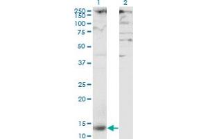 Western Blot analysis of CLEC4M expression in transfected 293T cell line by CLEC4M monoclonal antibody (M01), clone 2G1.