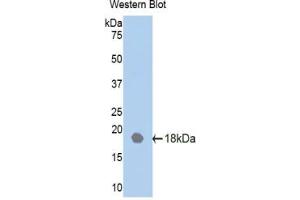 Western blot analysis of the recombinant protein. (IL18RAP 抗体  (AA 117-240))