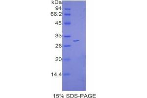 SDS-PAGE analysis of Mouse Catenin beta 1 Protein. (CTNNB1 蛋白)