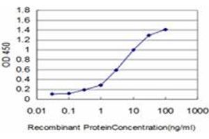 Detection limit for recombinant GST tagged KIAA2002 is approximately 0. (PEAK1 抗体  (AA 1151-1250))
