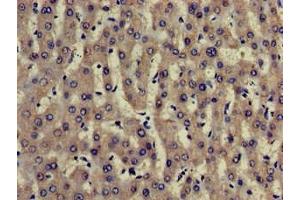 Immunohistochemistry of paraffin-embedded human liver tissue using ABIN7173904 at dilution of 1:100 (TRADD 抗体  (AA 1-312))