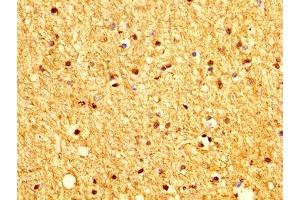 IHC image of ABIN7165907 diluted at 1:200 and staining in paraffin-embedded human brain tissue performed on a Leica BondTM system. (Patched 2 抗体  (AA 793-951))
